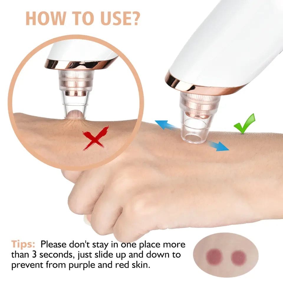 blackhead vacuum machine, dust remover, dirt remover, Pimple Popper Tool Pore Vacuum Black Head Remover, Whitehead Acne remover